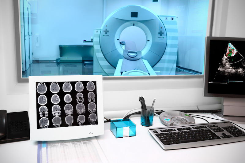AI Reduces CT Scan Risks for Brain Injury Patients
